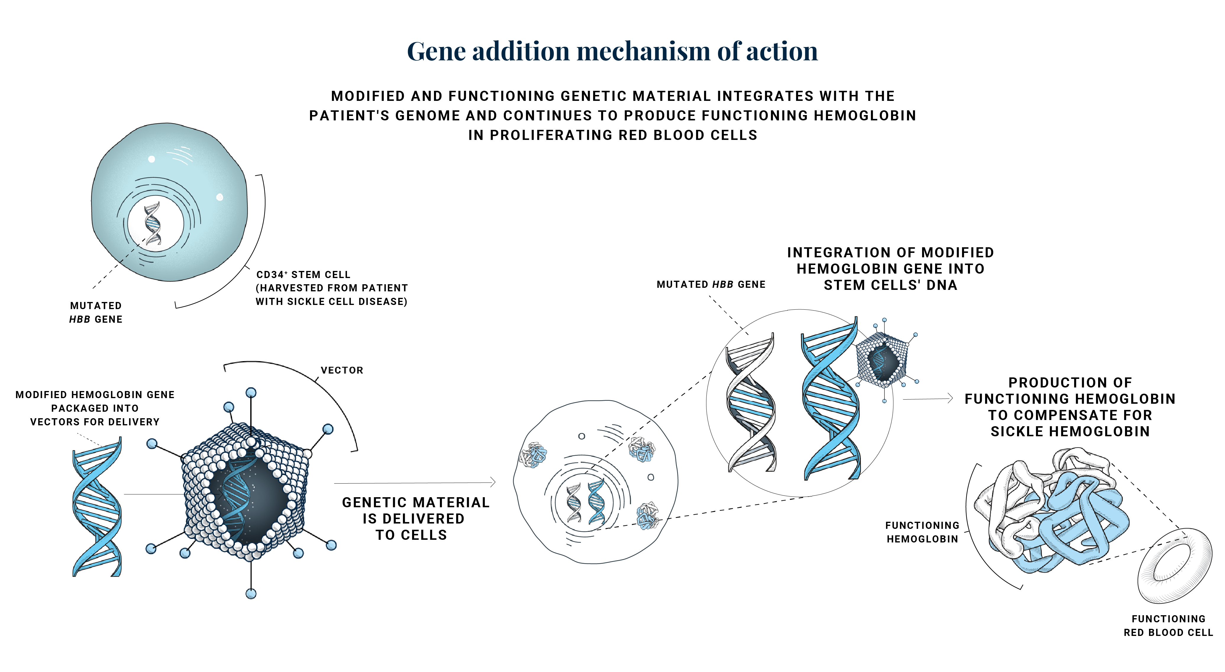 Gene addition mechanism of action for sickle cell disease