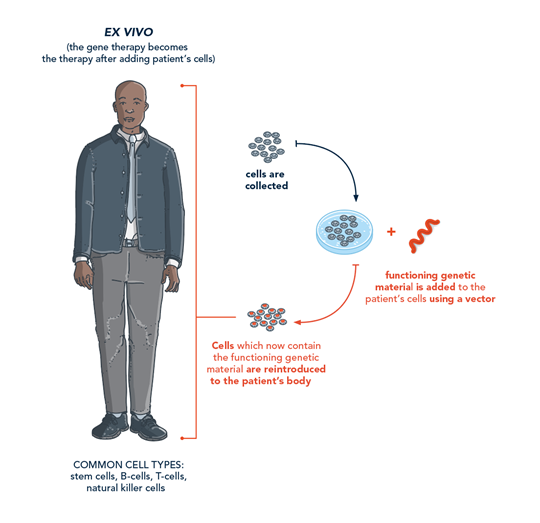 Image of ex vivo gene therapy